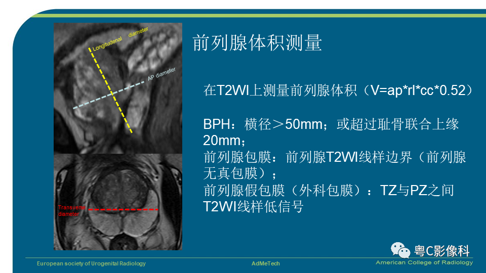影像PPT - 【PPT】PI-RADS v2.1 修订解读并浅谈临床应用局限性-10 影像PPT - 【PPT】PI-RADS v2.1 修订解读并浅谈临床应用局限性-10