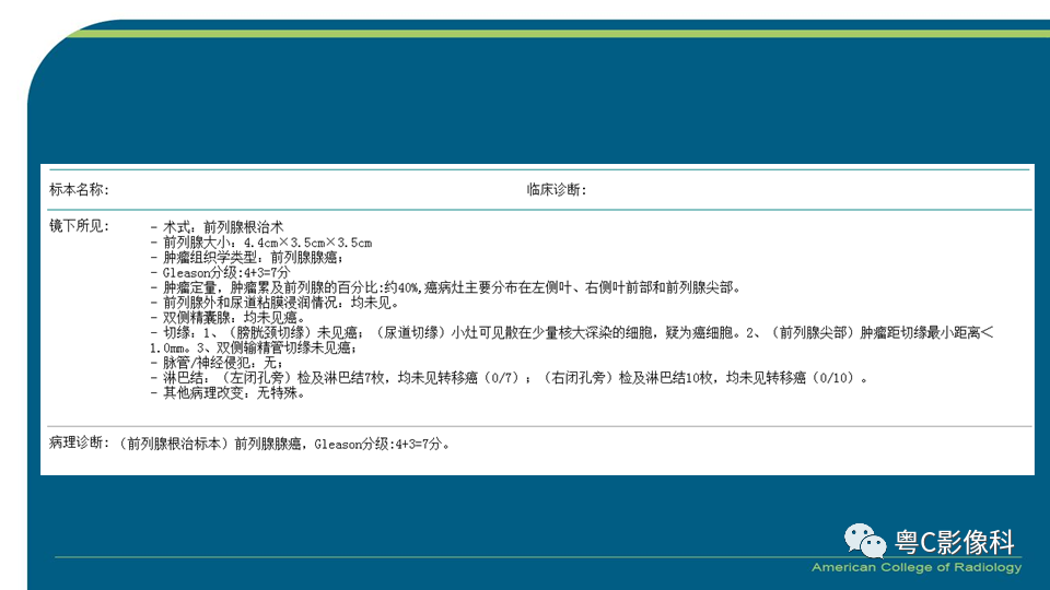 影像PPT - 【PPT】PI-RADS v2.1 修订解读并浅谈临床应用局限性-26 影像PPT - 【PPT】PI-RADS v2.1 修订解读并浅谈临床应用局限性-26