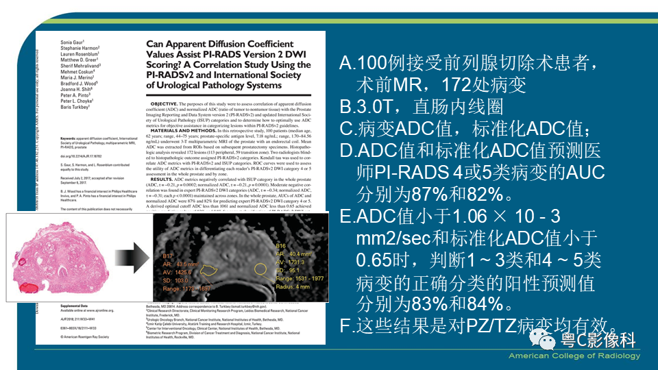 影像PPT - 【PPT】PI-RADS v2.1 修订解读并浅谈临床应用局限性-61 影像PPT - 【PPT】PI-RADS v2.1 修订解读并浅谈临床应用局限性-61