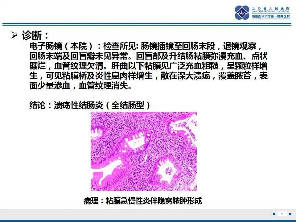 影像PPT - 【PPT】溃疡性结肠炎-11