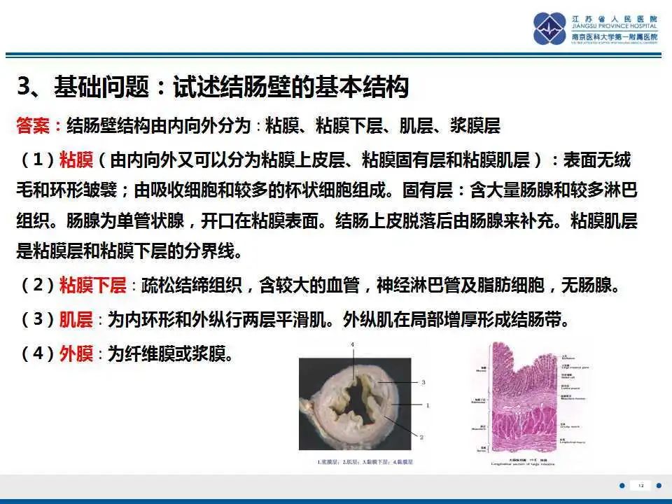 影像PPT - 【PPT】溃疡性结肠炎-13