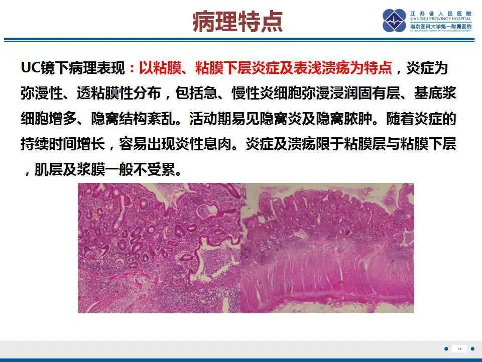 影像PPT - 【PPT】溃疡性结肠炎-18
