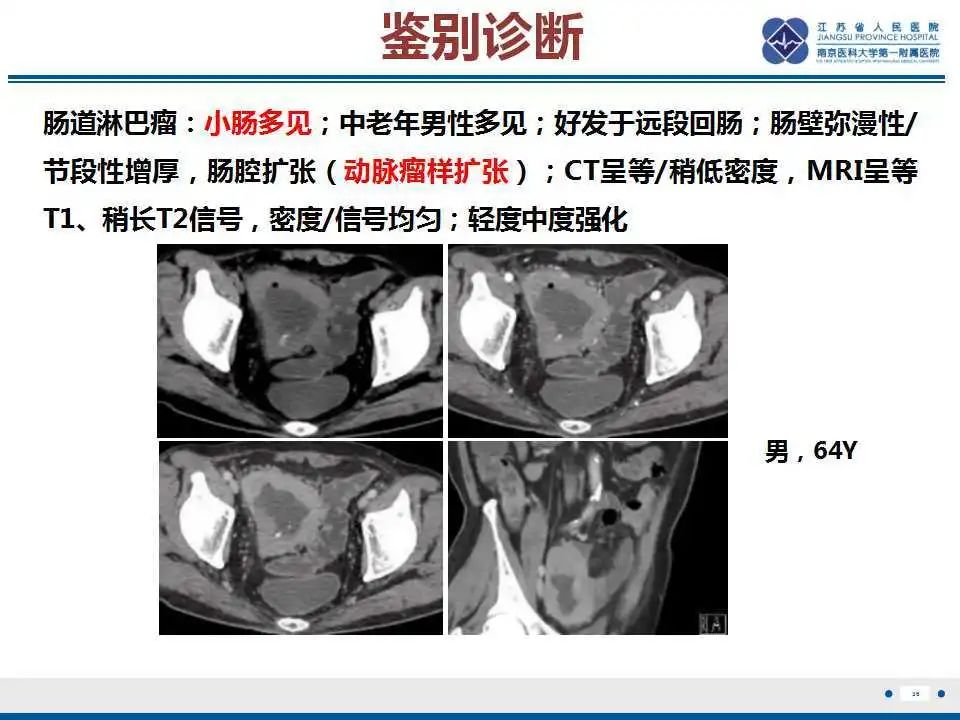 影像PPT - 【PPT】溃疡性结肠炎-37