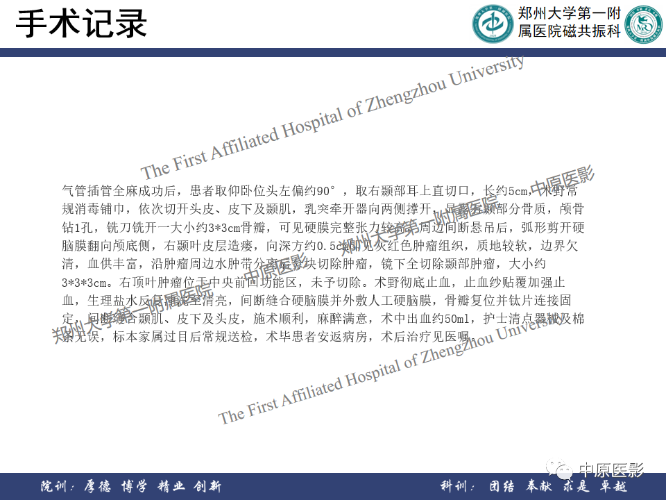 影像PPT - 【病例】原发性中枢神经系统淋巴瘤1例MR影像-11