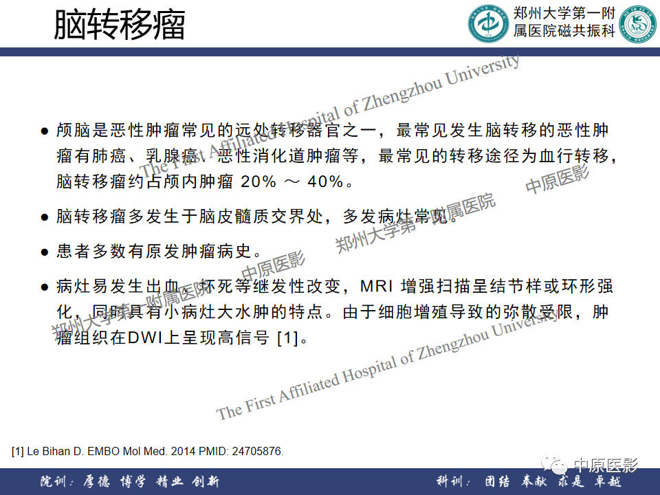 影像PPT - 【病例】原发性中枢神经系统淋巴瘤1例MR影像-18