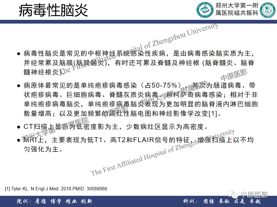 影像PPT - 【病例】原发性中枢神经系统淋巴瘤1例MR影像-20