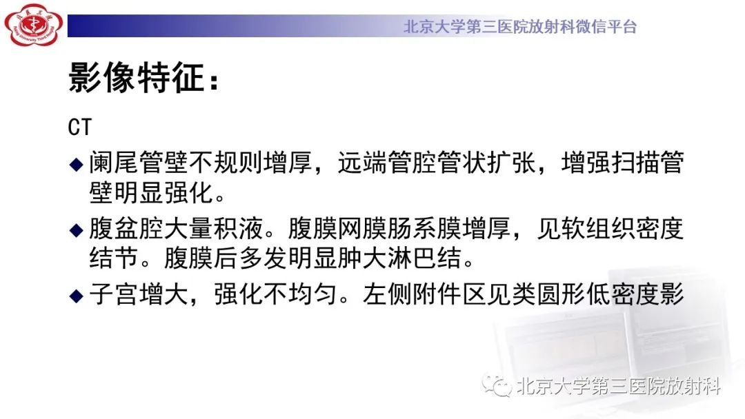 影像PPT - 【PPT】阑尾粘液性肿瘤-13
