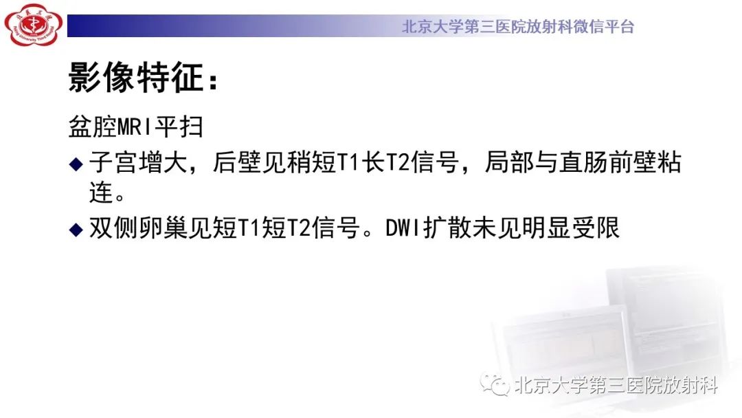影像PPT - 【PPT】阑尾粘液性肿瘤-14