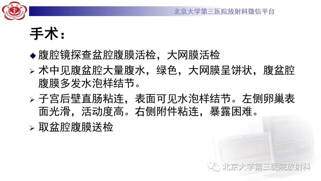 影像PPT - 【PPT】阑尾粘液性肿瘤-16