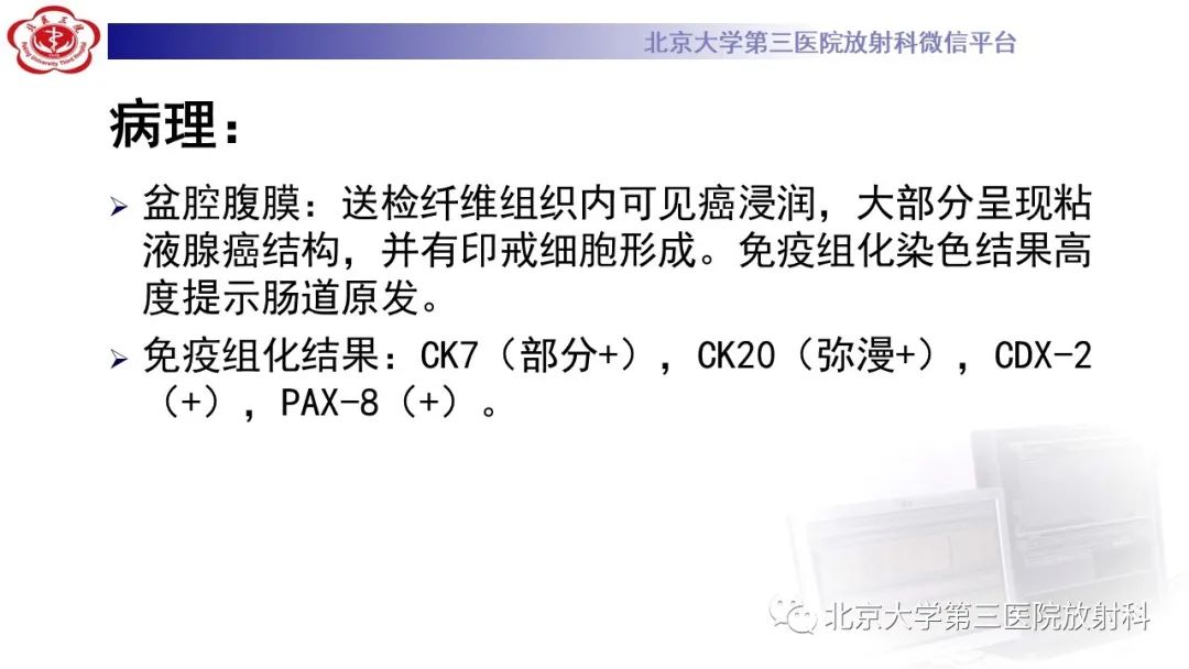 影像PPT - 【PPT】阑尾粘液性肿瘤-17