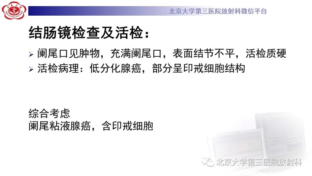 影像PPT - 【PPT】阑尾粘液性肿瘤-18