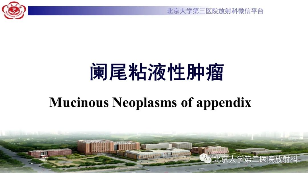 影像PPT - 【PPT】阑尾粘液性肿瘤-19