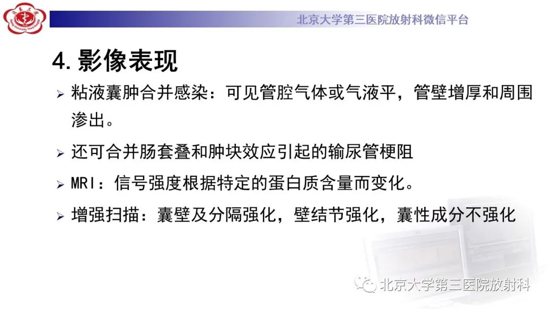 影像PPT - 【PPT】阑尾粘液性肿瘤-27