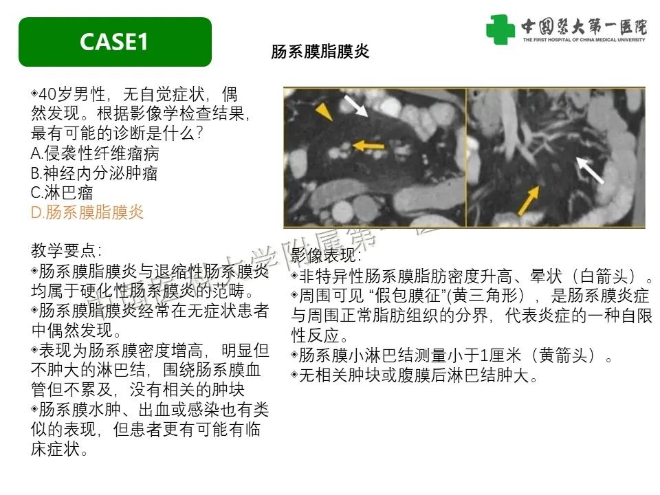 影像PPT - 【PPT】肠系膜病变的要点及鉴别诊断-5