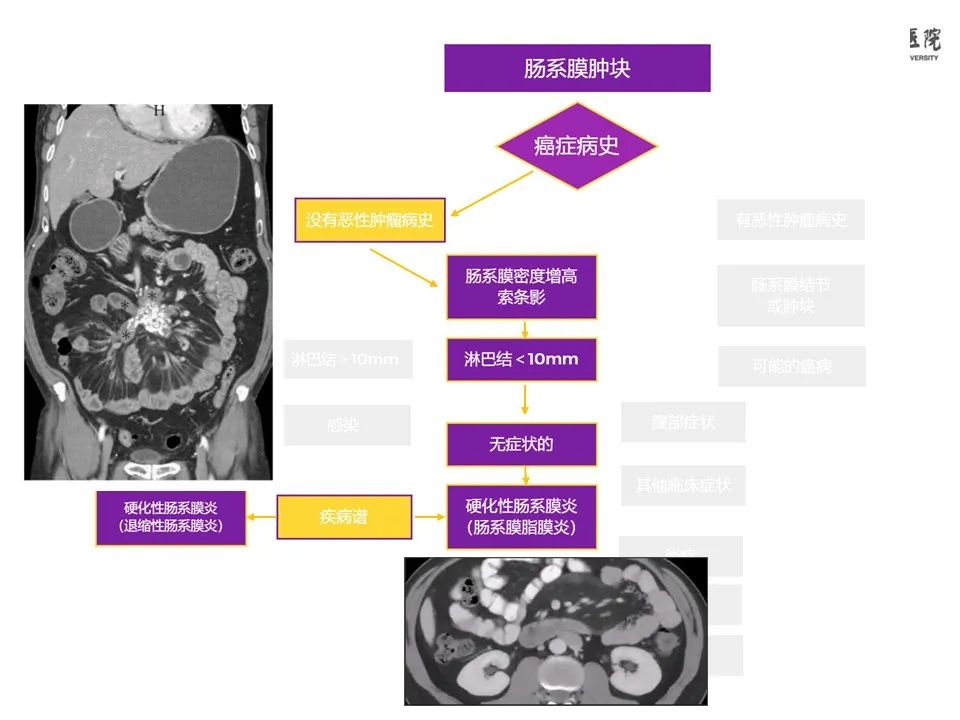 影像PPT - 【PPT】肠系膜病变的要点及鉴别诊断-8
