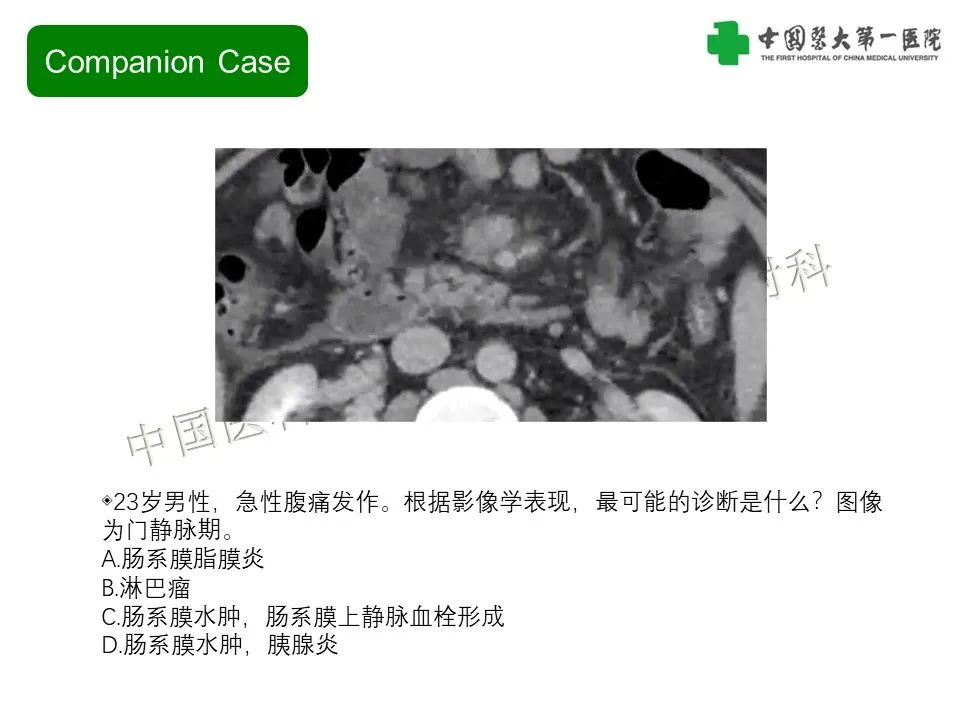 影像PPT - 【PPT】肠系膜病变的要点及鉴别诊断-9