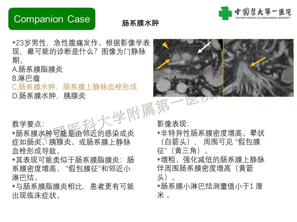 影像PPT - 【PPT】肠系膜病变的要点及鉴别诊断-10