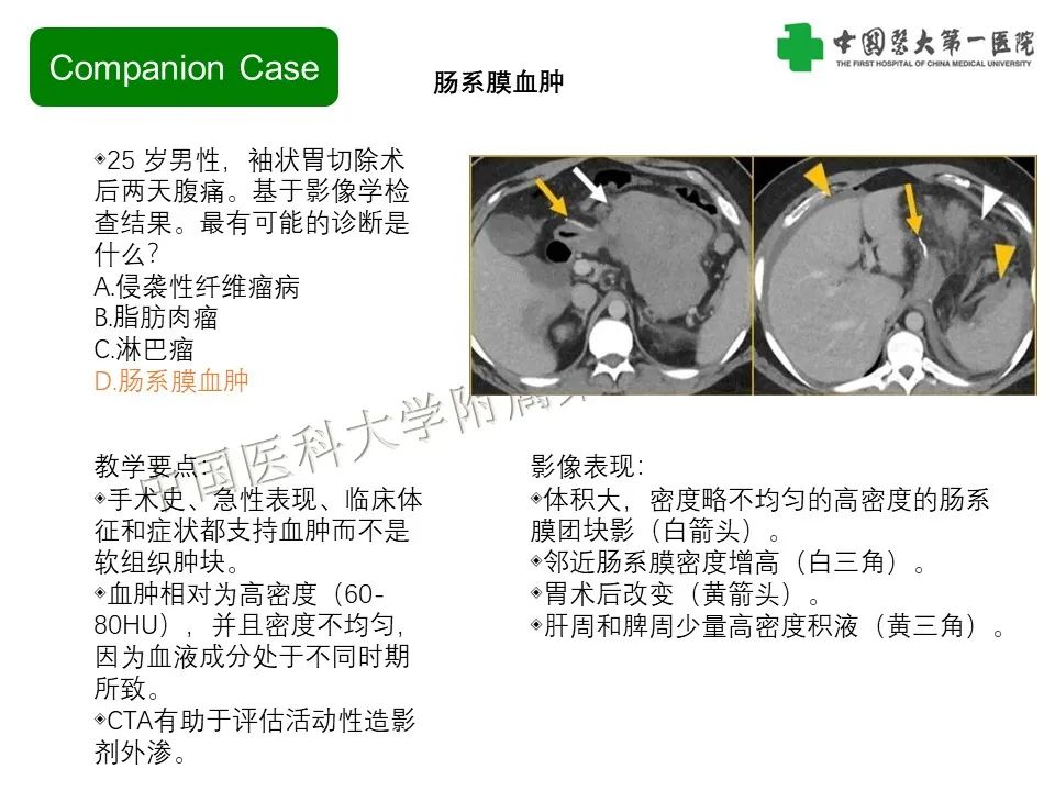 影像PPT - 【PPT】肠系膜病变的要点及鉴别诊断-13
