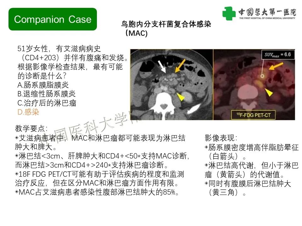 影像PPT - 【PPT】肠系膜病变的要点及鉴别诊断-15