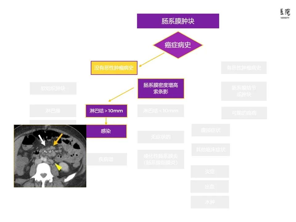 影像PPT - 【PPT】肠系膜病变的要点及鉴别诊断-16