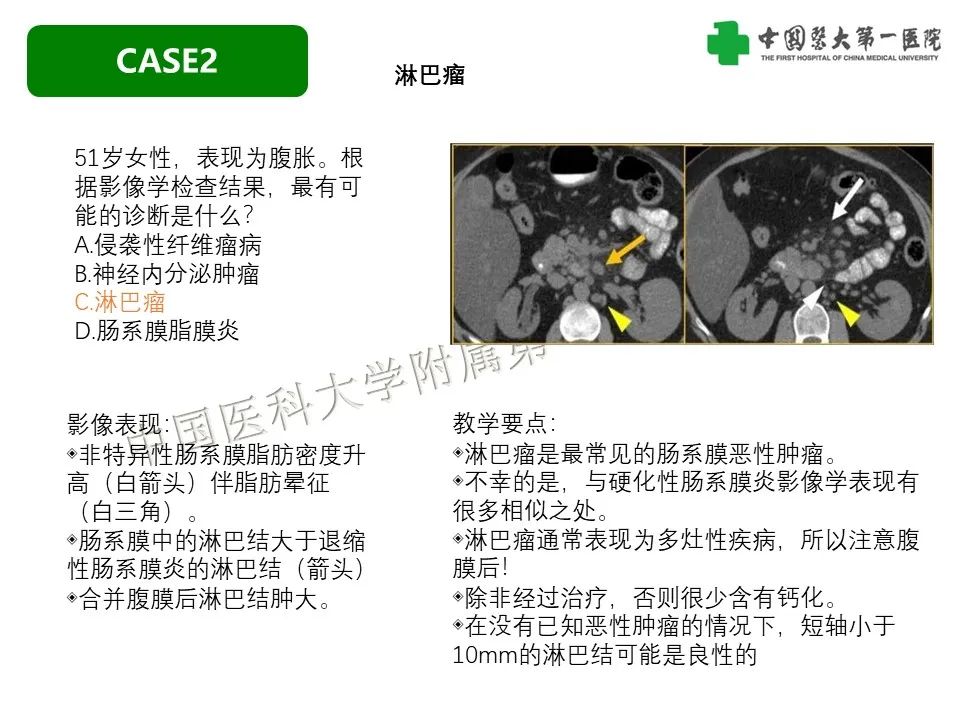 影像PPT - 【PPT】肠系膜病变的要点及鉴别诊断-18
