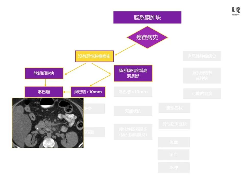 影像PPT - 【PPT】肠系膜病变的要点及鉴别诊断-20