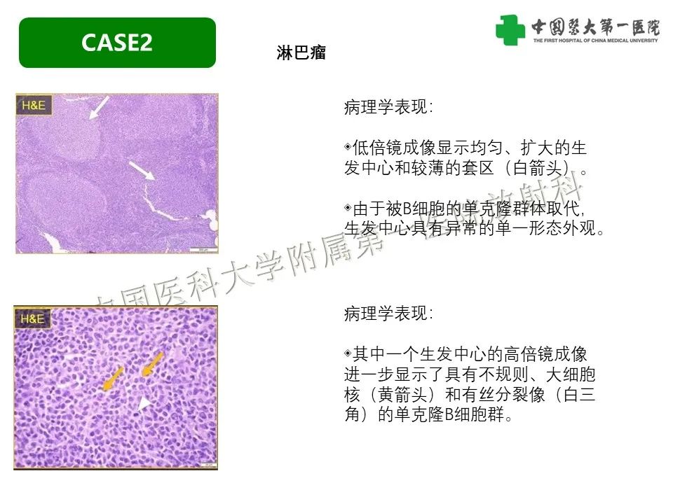 影像PPT - 【PPT】肠系膜病变的要点及鉴别诊断-19