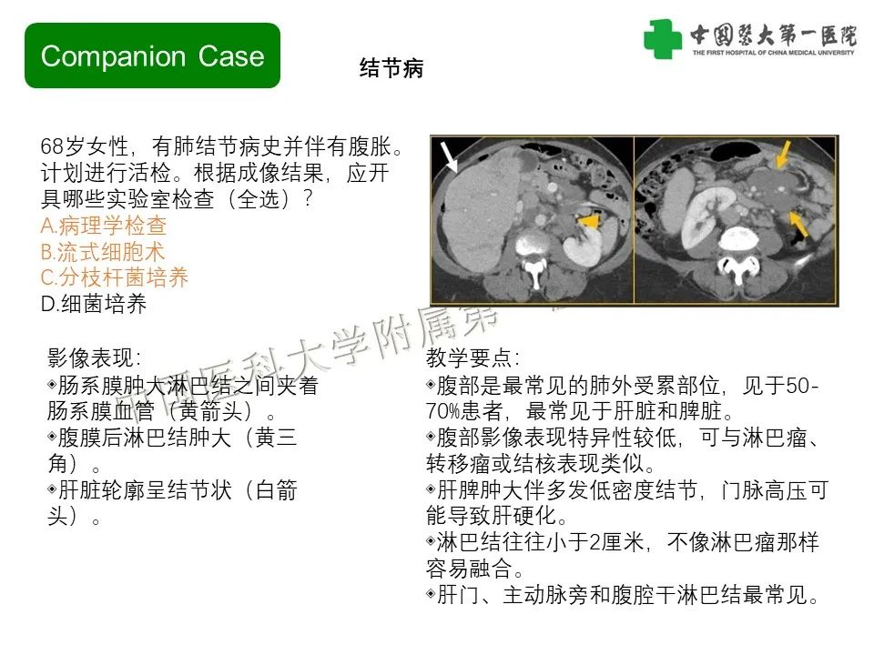 影像PPT - 【PPT】肠系膜病变的要点及鉴别诊断-24