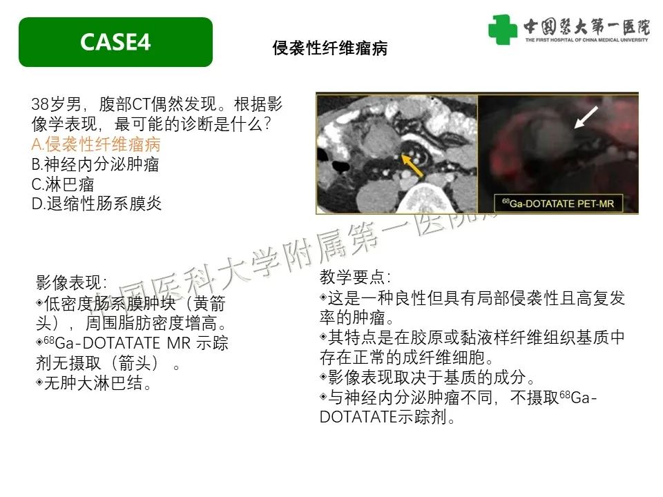 影像PPT - 【PPT】肠系膜病变的要点及鉴别诊断-28