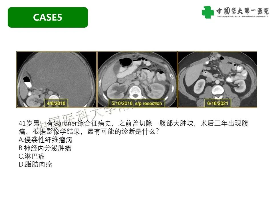 影像PPT - 【PPT】肠系膜病变的要点及鉴别诊断-29