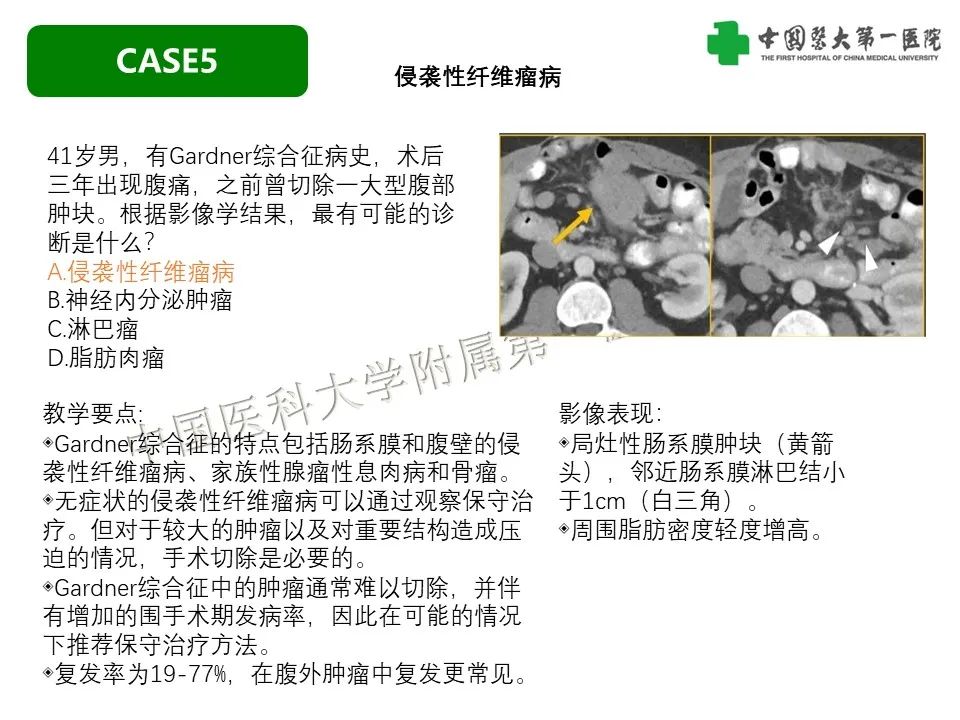 影像PPT - 【PPT】肠系膜病变的要点及鉴别诊断-30