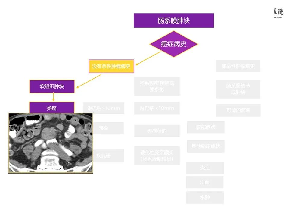 影像PPT - 【PPT】肠系膜病变的要点及鉴别诊断-37