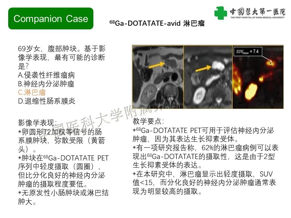 影像PPT - 【PPT】肠系膜病变的要点及鉴别诊断-39