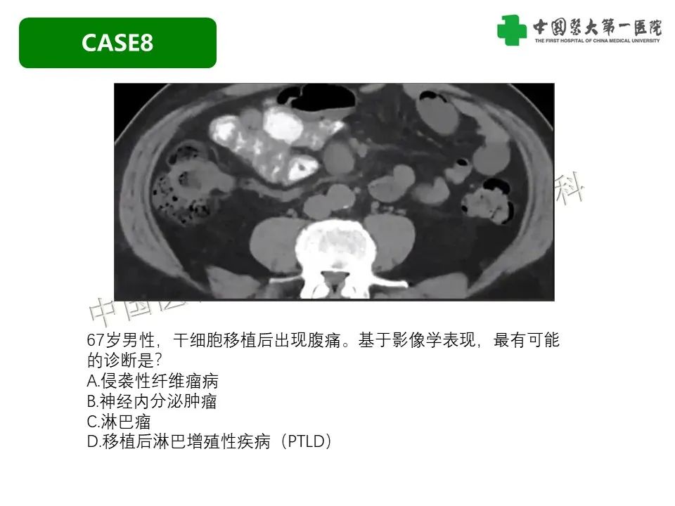 影像PPT - 【PPT】肠系膜病变的要点及鉴别诊断-40