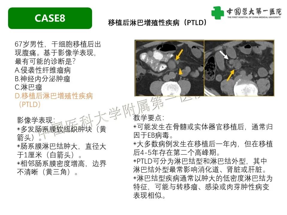 影像PPT - 【PPT】肠系膜病变的要点及鉴别诊断-41