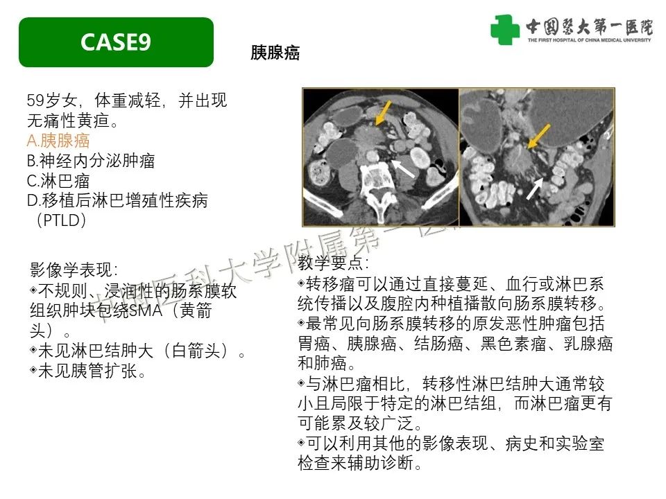 影像PPT - 【PPT】肠系膜病变的要点及鉴别诊断-43
