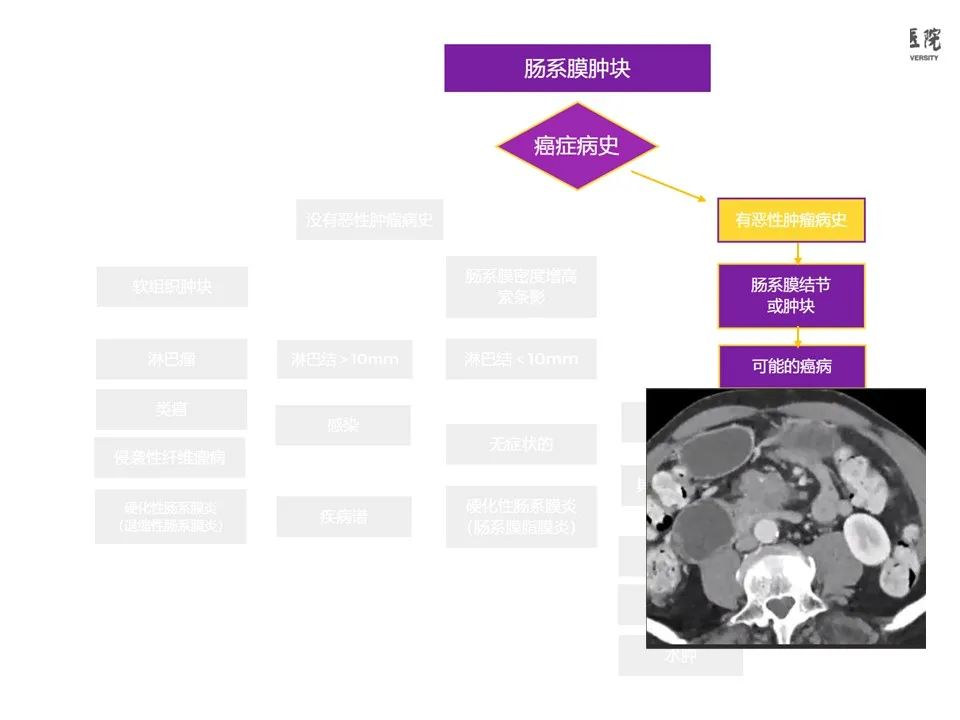 影像PPT - 【PPT】肠系膜病变的要点及鉴别诊断-44