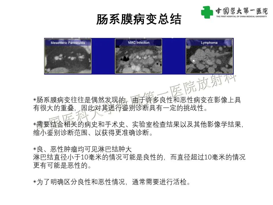 影像PPT - 【PPT】肠系膜病变的要点及鉴别诊断-52