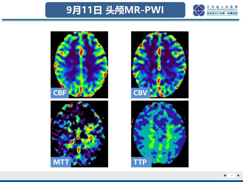 影像PPT - 【PPT】多结节及空泡样神经元肿瘤-6
