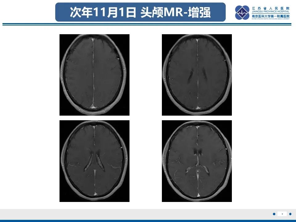 影像PPT - 【PPT】多结节及空泡样神经元肿瘤-9