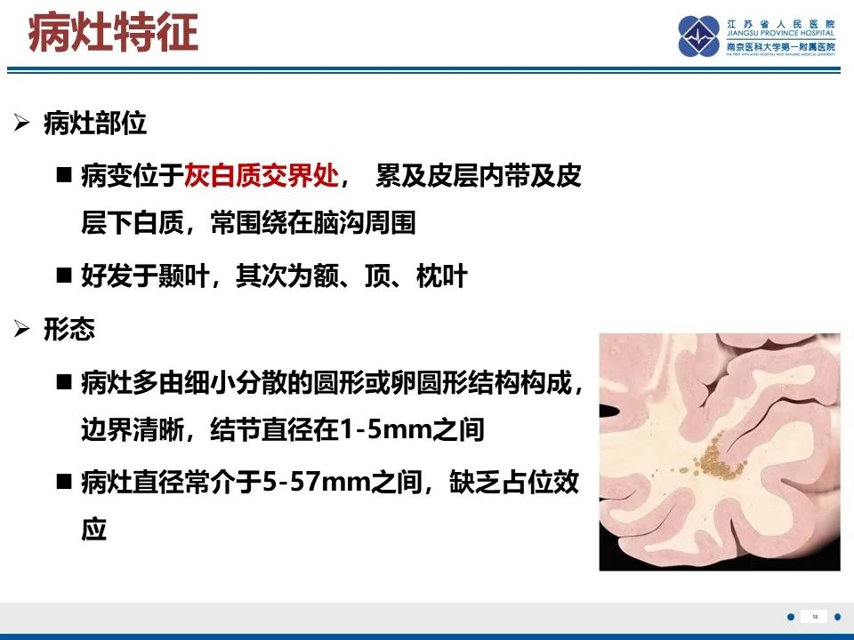 影像PPT - 【PPT】多结节及空泡样神经元肿瘤-19