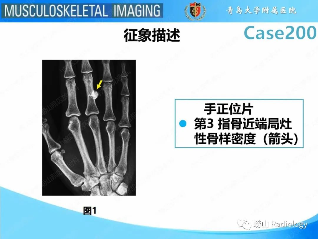 影像PPT - 【PPT】Nora病-11