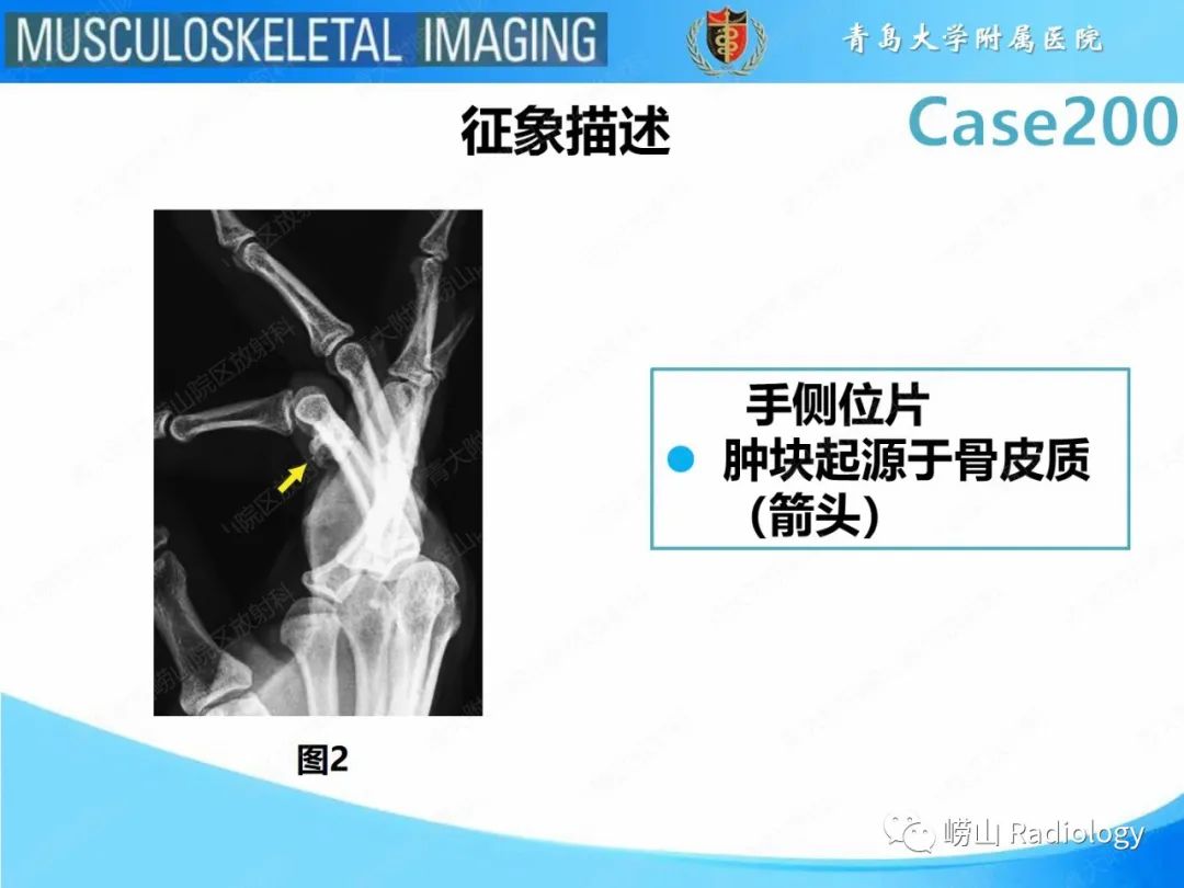影像PPT - 【PPT】Nora病-12