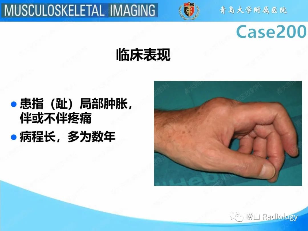 影像PPT - 【PPT】Nora病-17