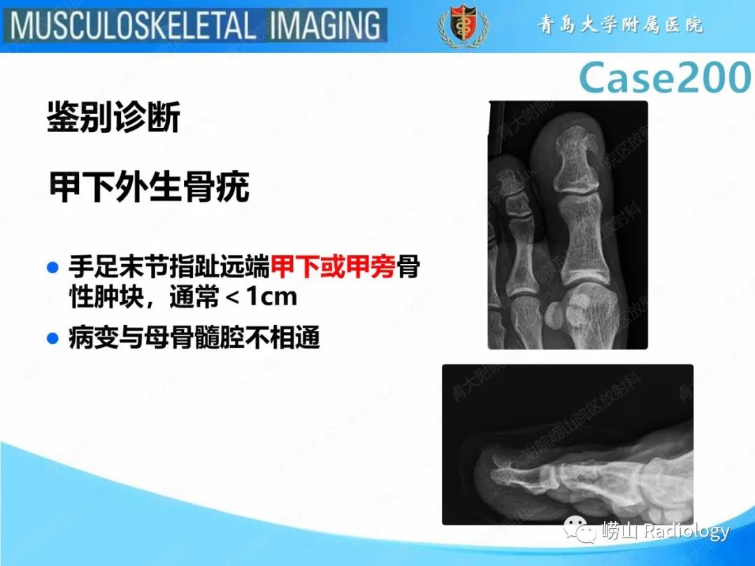 影像PPT - 【PPT】Nora病-22