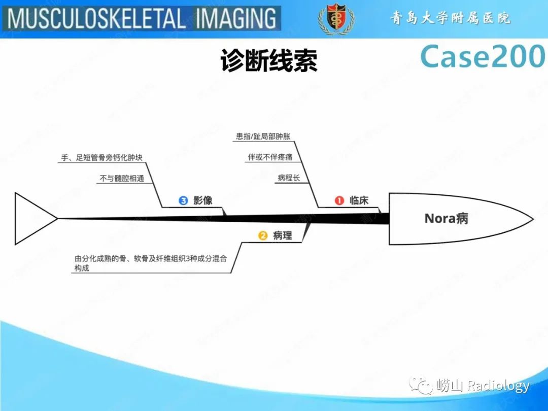 影像PPT - 【PPT】Nora病-26