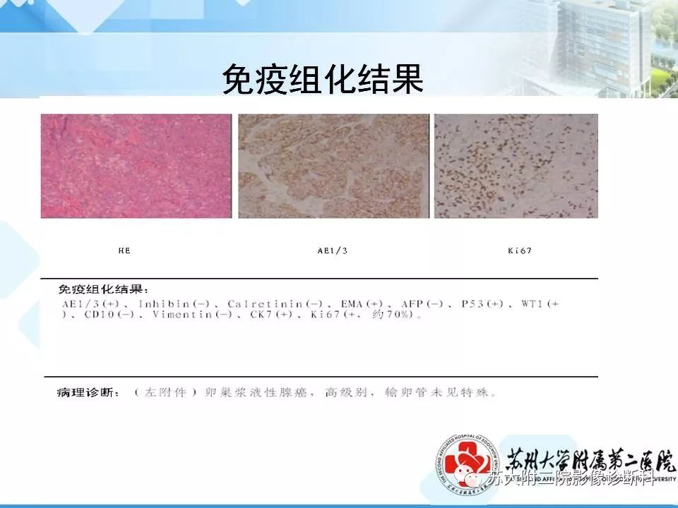 影像PPT - 【病例】卵巢浆液性腺癌 VS 浆液性囊腺瘤-8