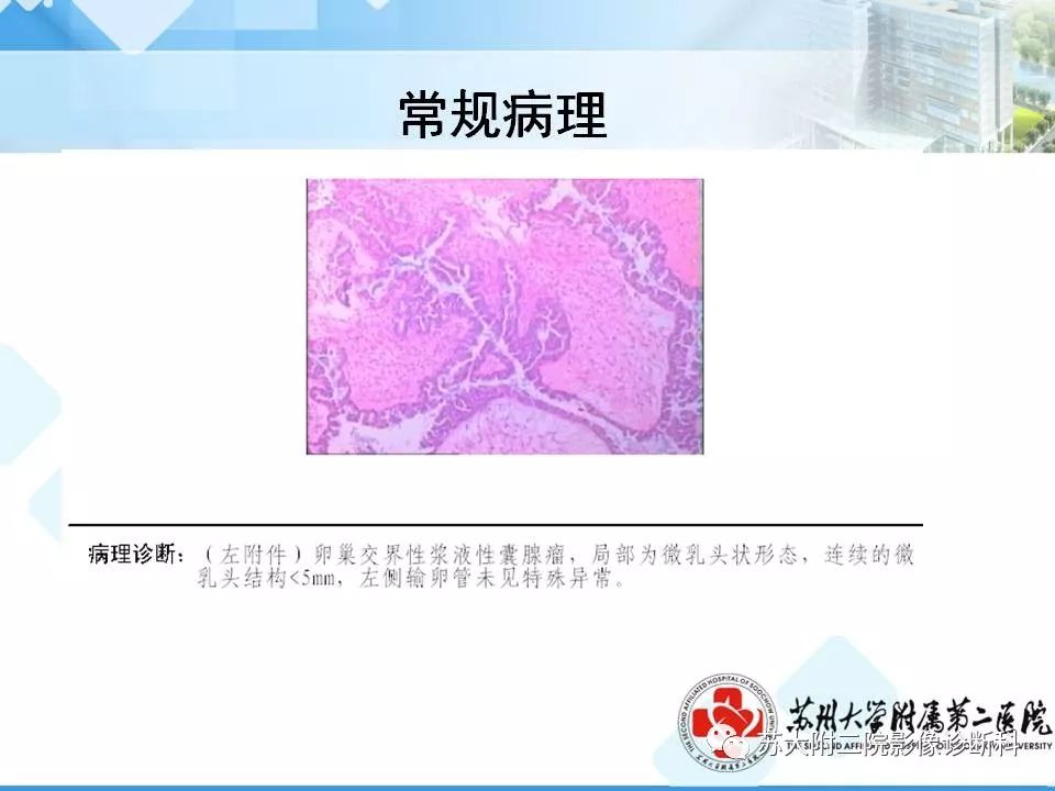 影像PPT - 【病例】卵巢浆液性腺癌 VS 浆液性囊腺瘤-19