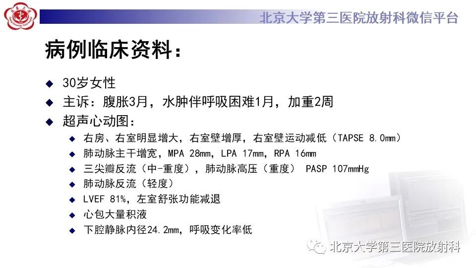 影像PPT - 【PPT】肺动脉高压的影像评估-2