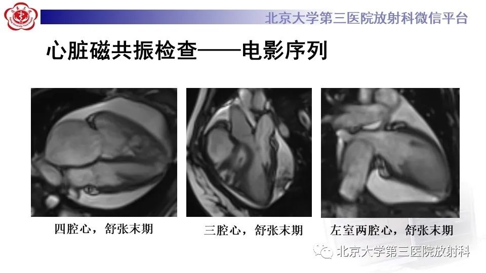 影像PPT - 【PPT】肺动脉高压的影像评估-5